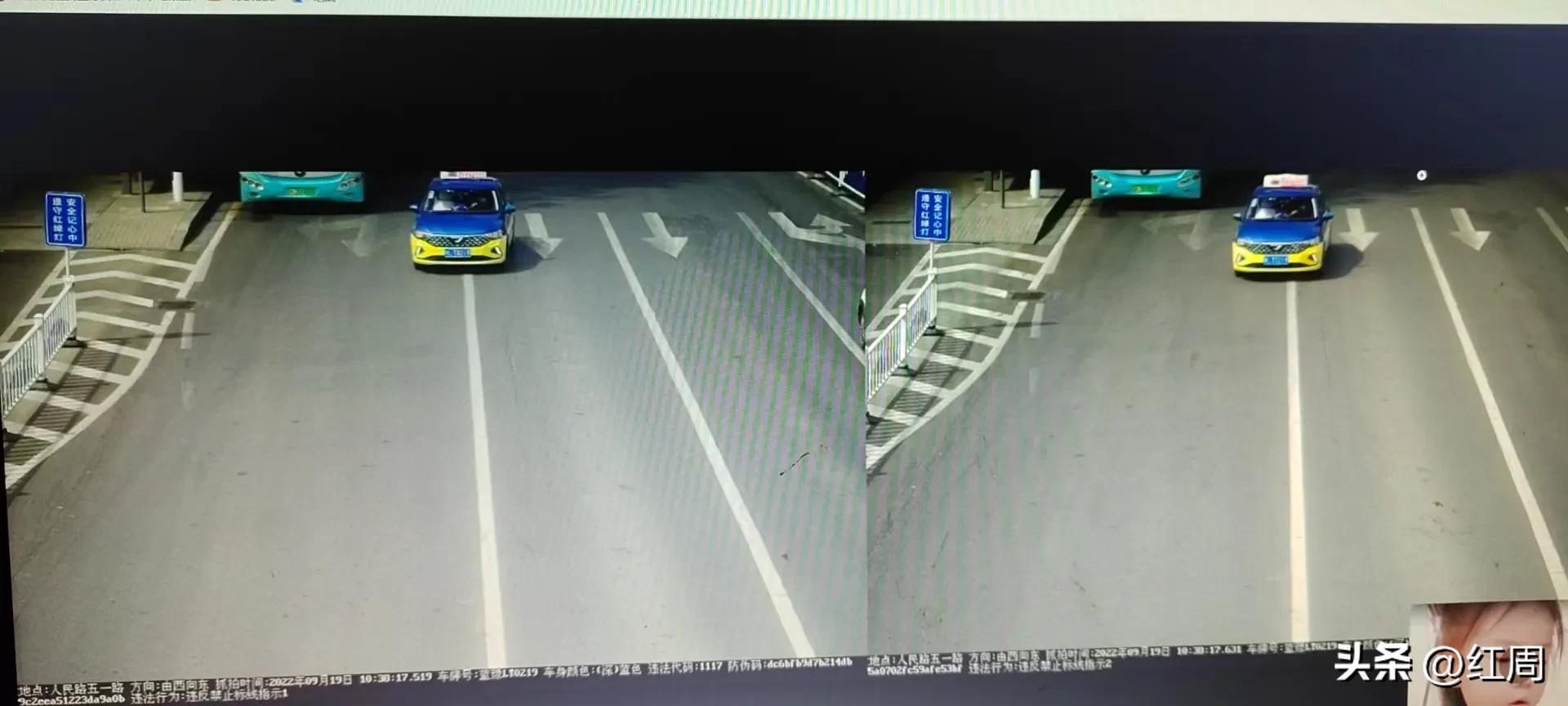 拔牙后死亡新闻,拔牙视频儿童