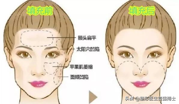 40岁的女人要做哪些简单医美,女人40做什么医美项目