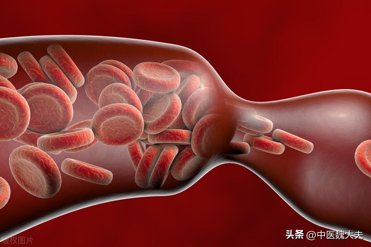 血液变浓有哪些症状,身体若有3个症状提示血液已粘稠