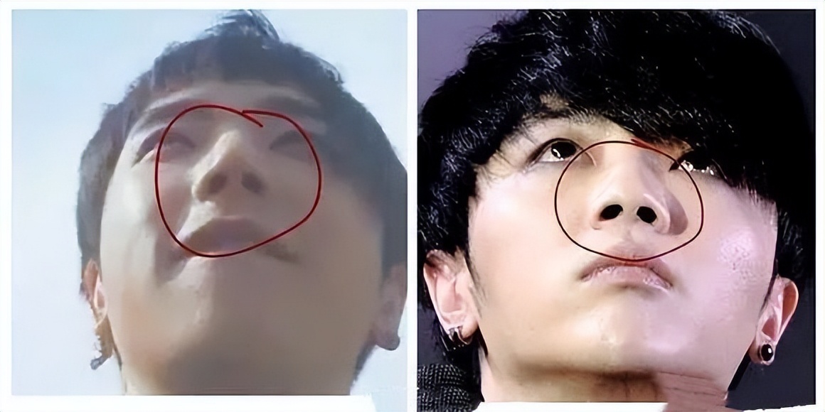 华晨宇削下颌骨的后果,华晨宇下颌骨内推