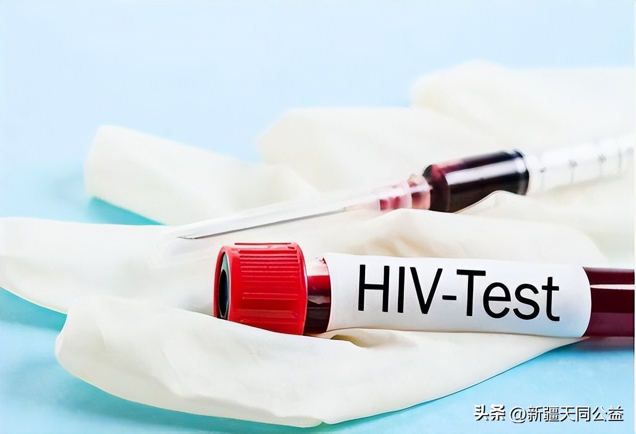 不要错把艾滋病当皮肤病，身体若有3变化，或是艾滋病的信号