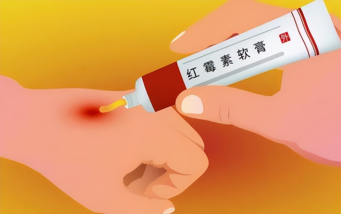 红霉素软膏的淡斑方法小妙招,2元钱的红霉素软膏能治疗什么病