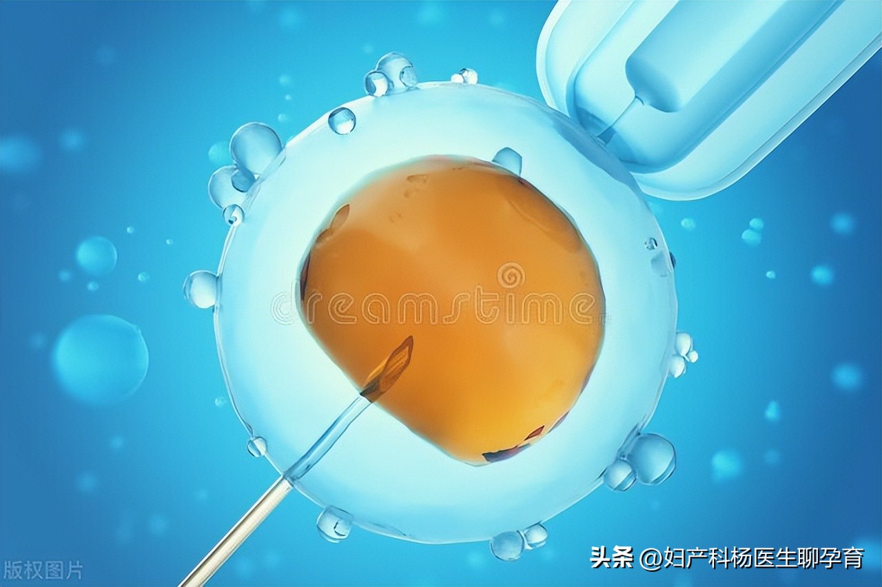 有卵巢囊肿又有多囊卵巢综合征,卵巢囊肿超声检查一般显示什么