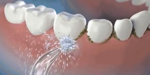 走皮皮虾！我们洗车去——我的洗车装备EDC