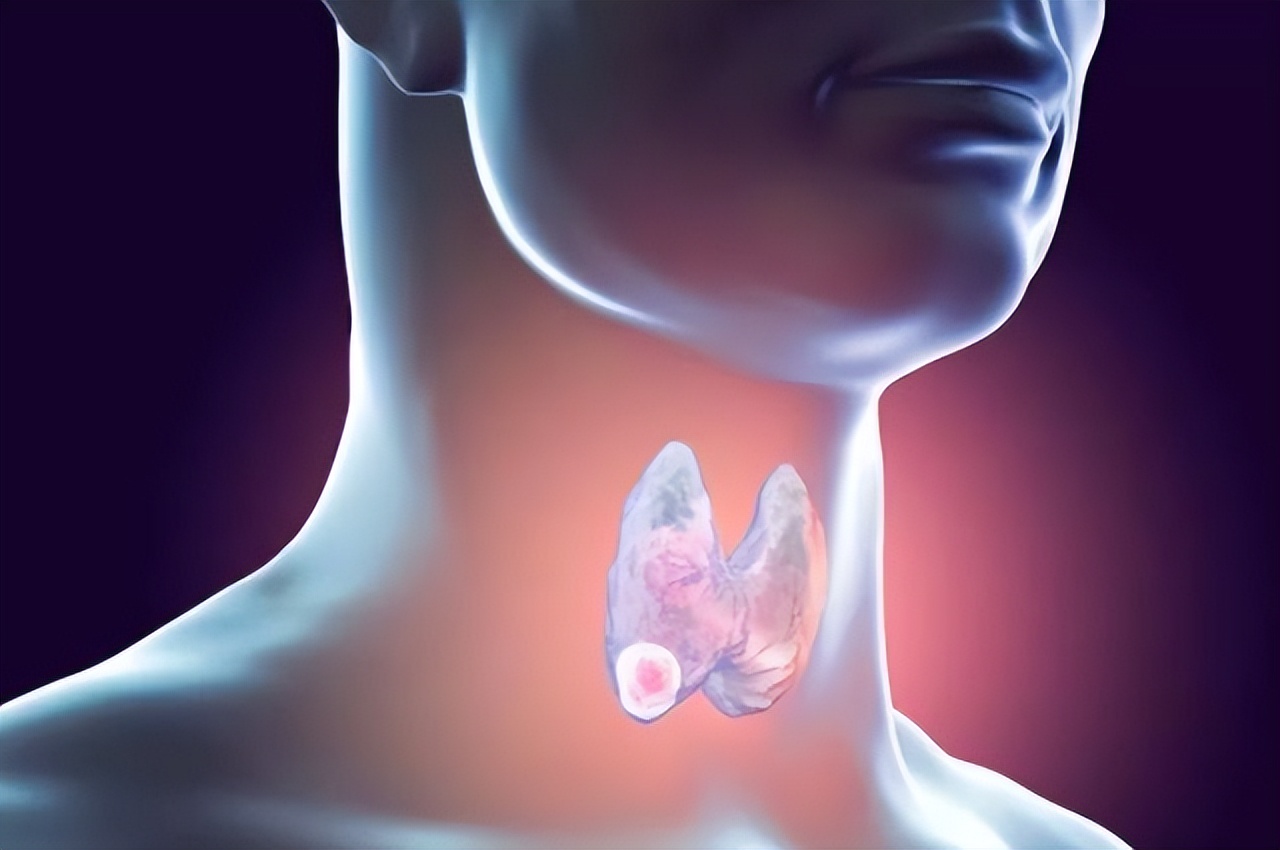 55岁男性体检应该检查哪些项目,体检一般检查哪些项目能预防癌症