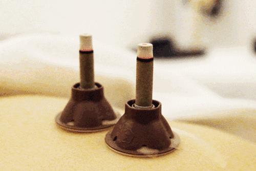 艾灸把身体烧了,艾灸完引火下行