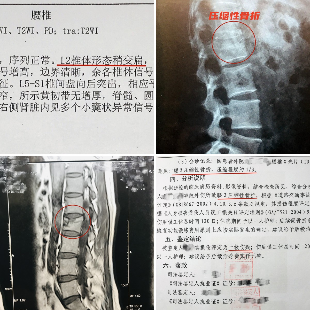 腰椎压缩性骨折睡什么样的床垫,腰椎间骨折要购买哪种床垫