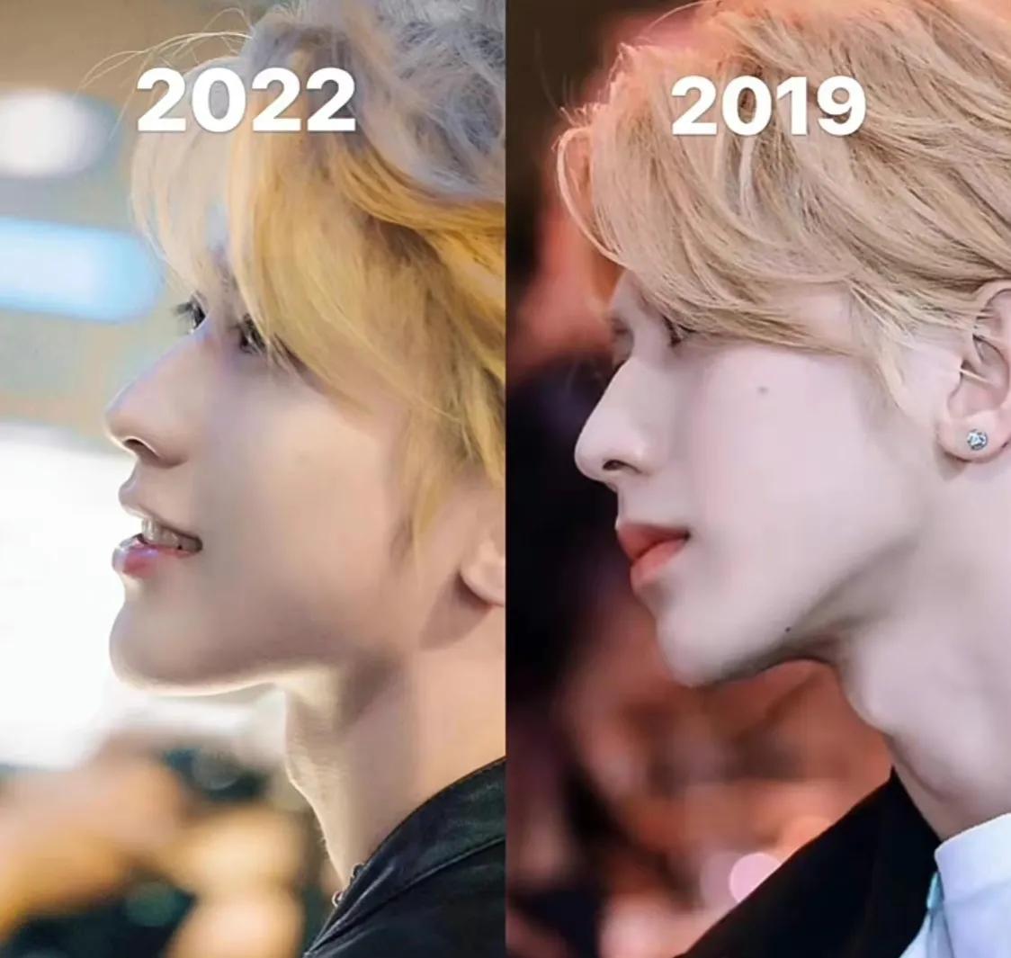 蔡徐坤疑似整容，费用居然高达一亿