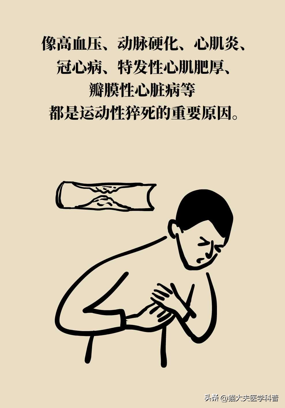 运动性猝死的六种表现,运动性猝死解释