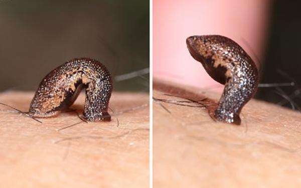 蚂蟥咬了有毒吗,误食蚂蟥会在人体内大量繁殖吗