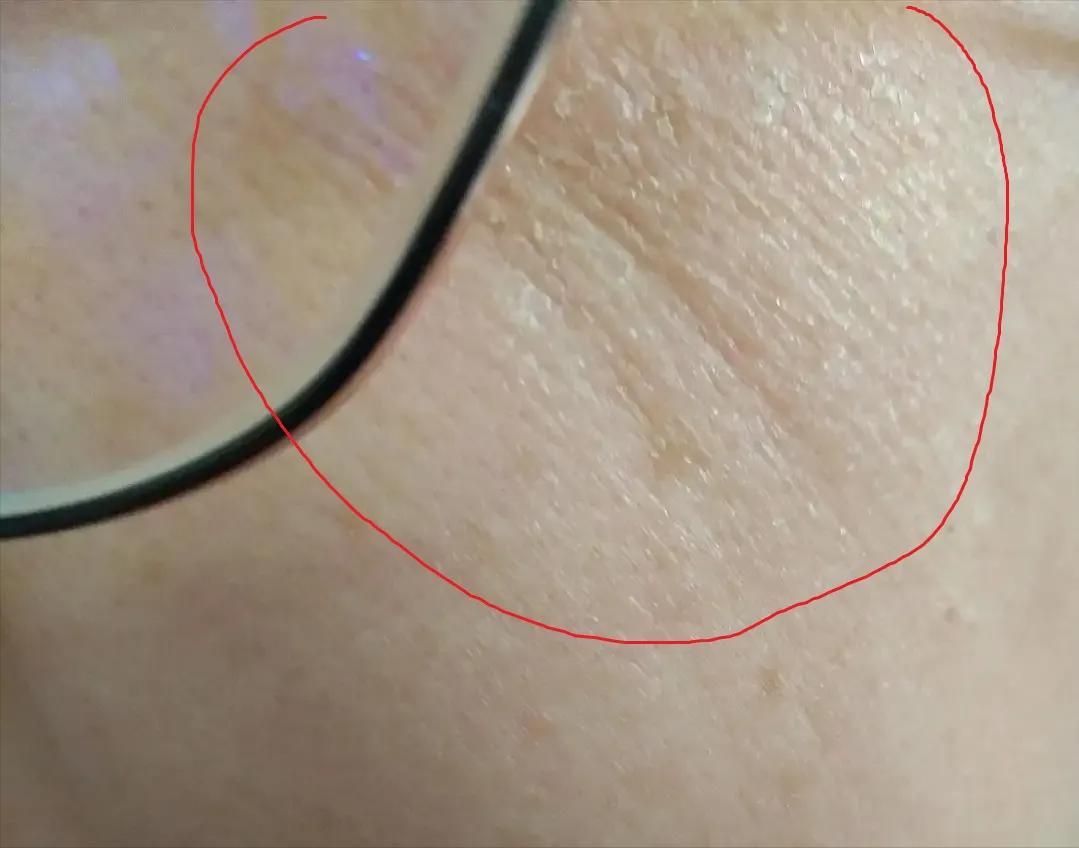 脸泛红是洗面奶的原因吗,为什么用完洗面奶脸会变白