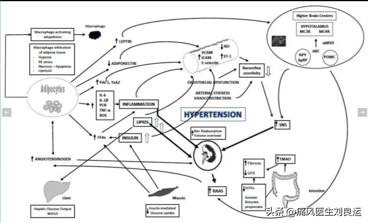 尿酸偏高无痛风症状怎么降尿酸,痛风所有尿酸升高均需降尿酸