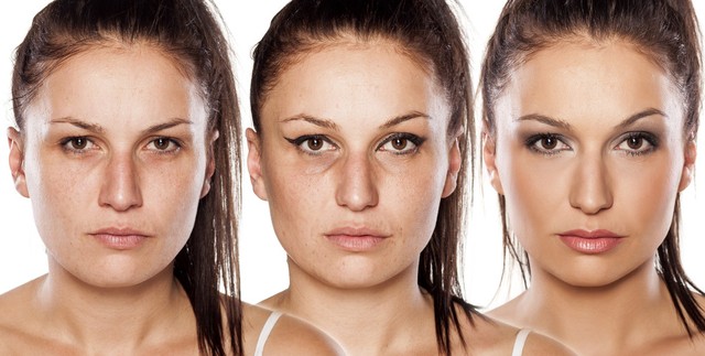 军训晒伤脸脱皮怎么办,军训会把头皮被晒伤吗