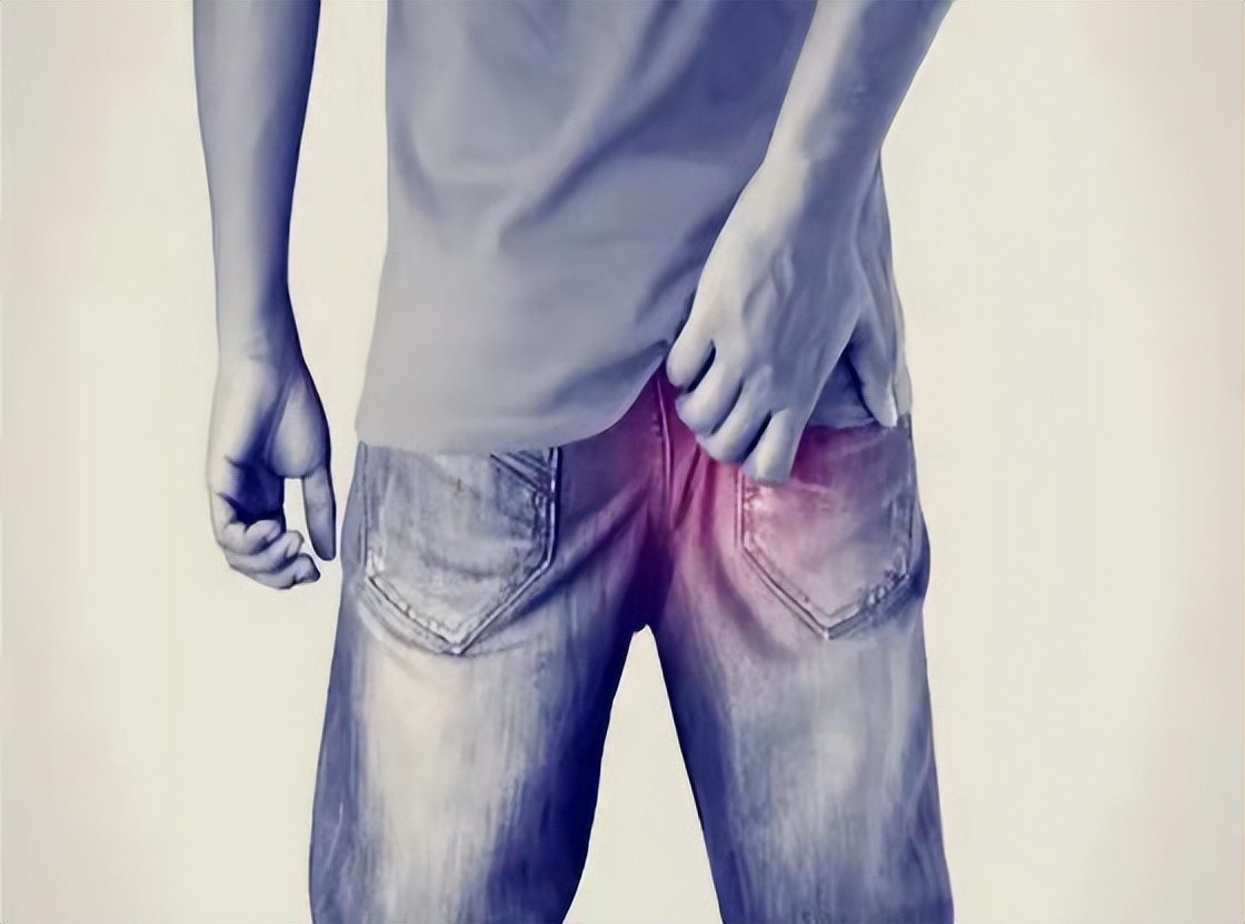 肛门瘙痒潮湿是什么原因怎么治疗,肛门周围潮湿又痒怎么治疗