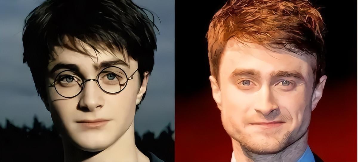 发腮和塌腮哪个更显老,发腮真的显老吗