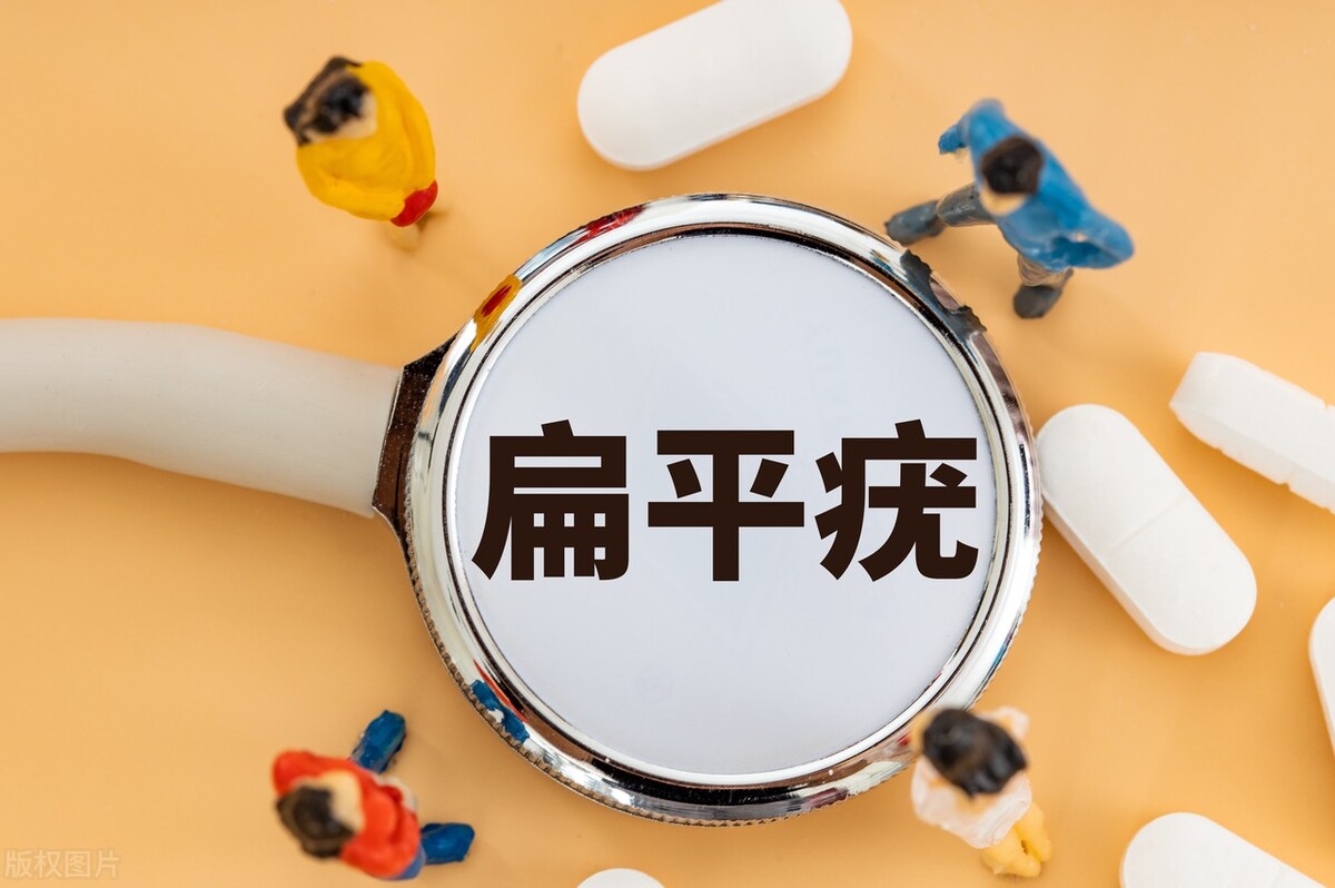 生姜治疗扁平疣有效吗,梁医生治疗扁平疣