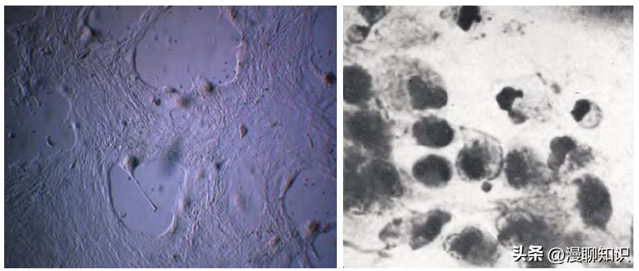 马疱疹病毒感染用什么治疗好,马病毒性疱疹