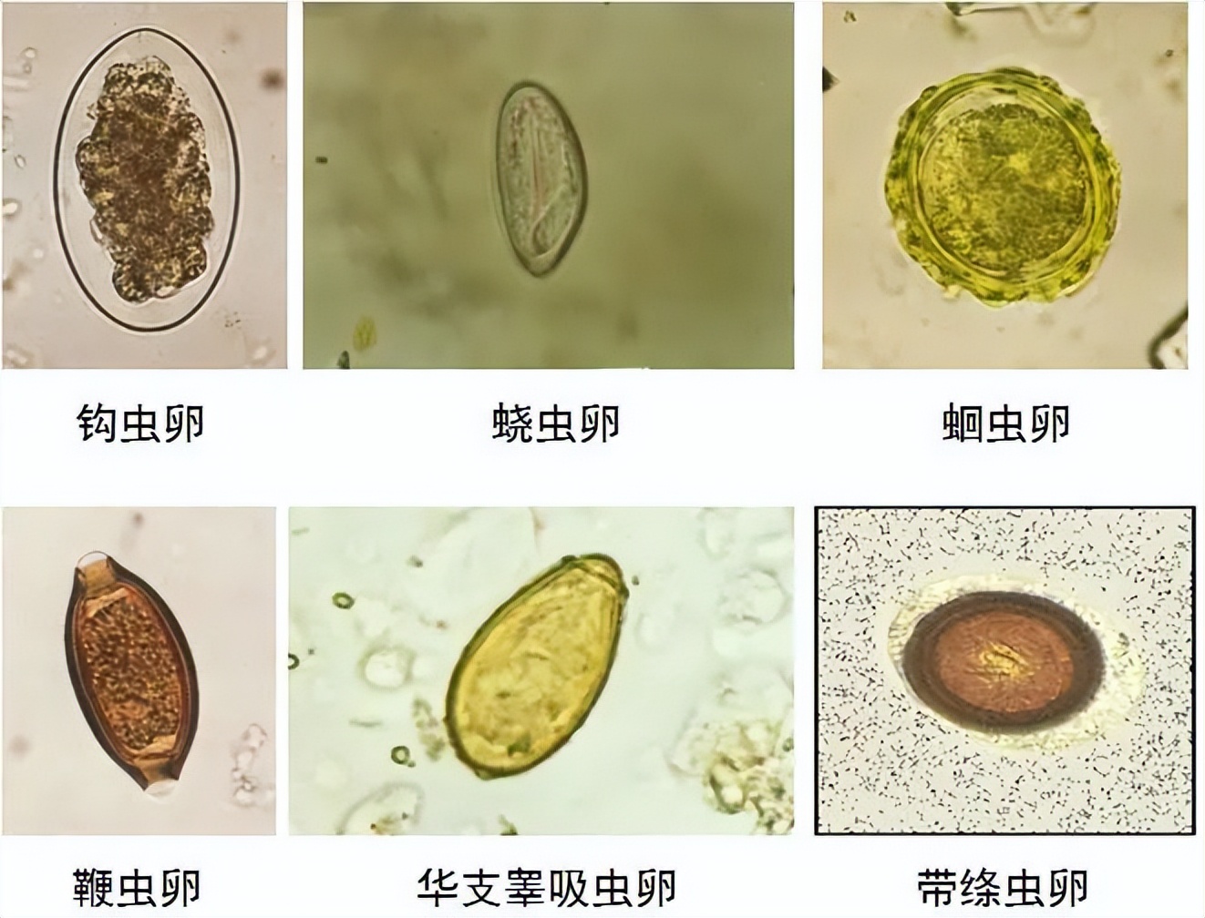 如果同时得了几种寄生虫病怎么治,现在寄生虫有哪些