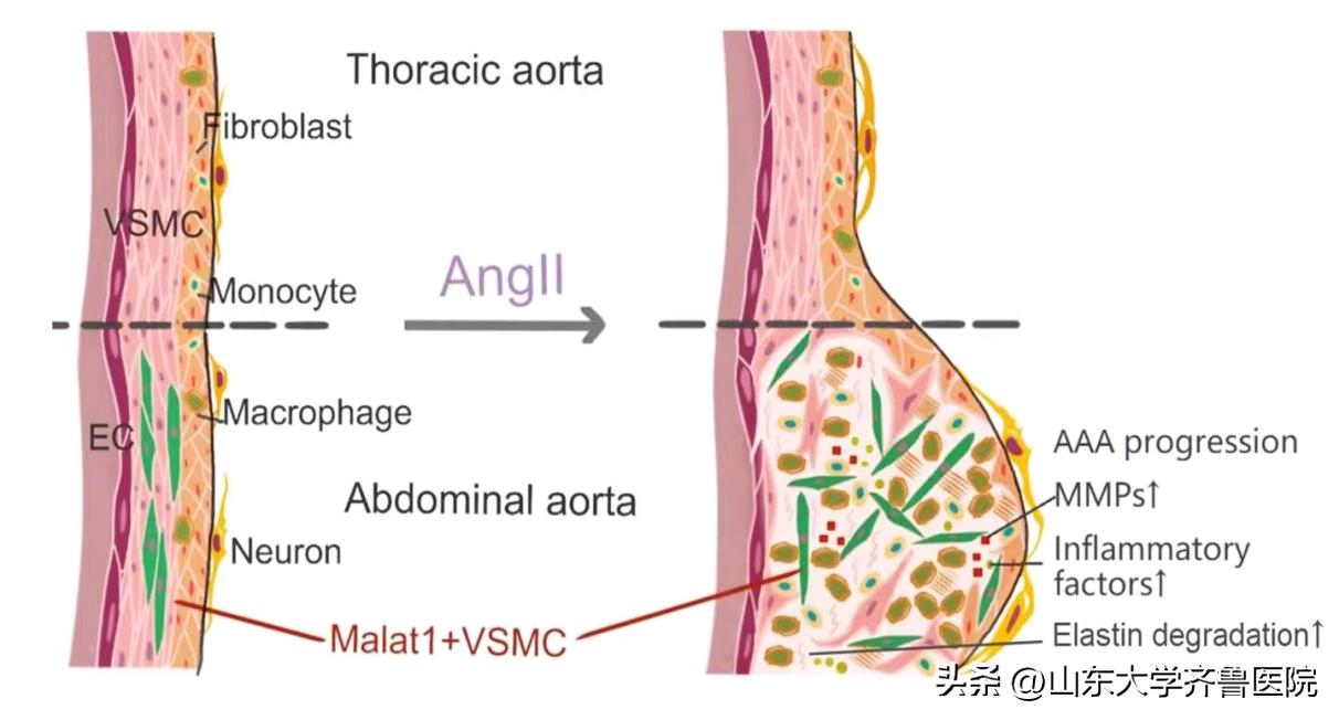 山东大学齐鲁医院心血管实验室基础研究取得系列重大进展
