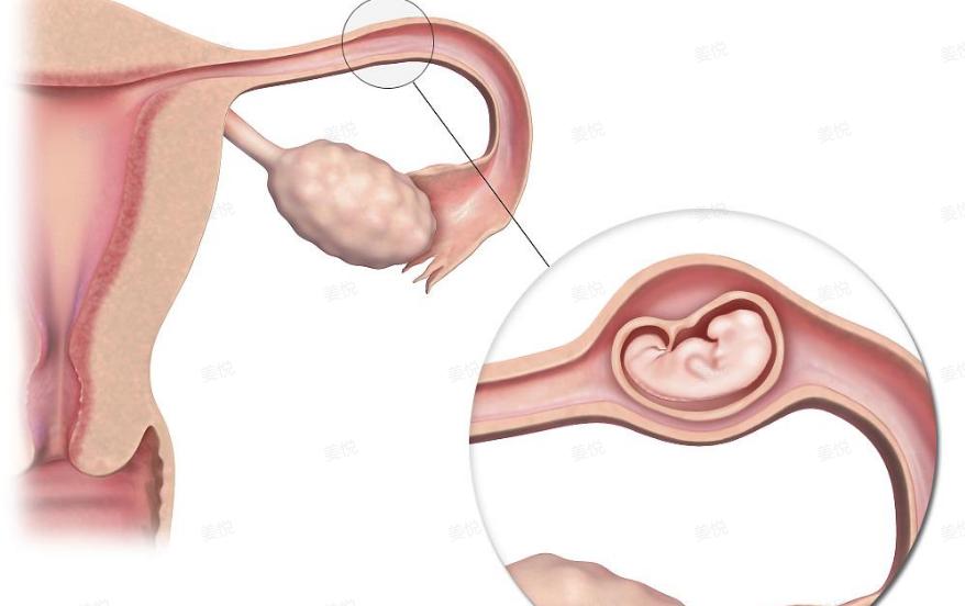 30多岁没有子宫有什么影响,没有子宫的女人可以试管吗