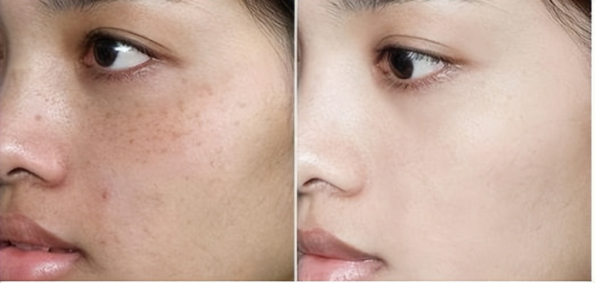 淡斑祛斑护肤品或精油,祛斑美白淡斑护肤品79元