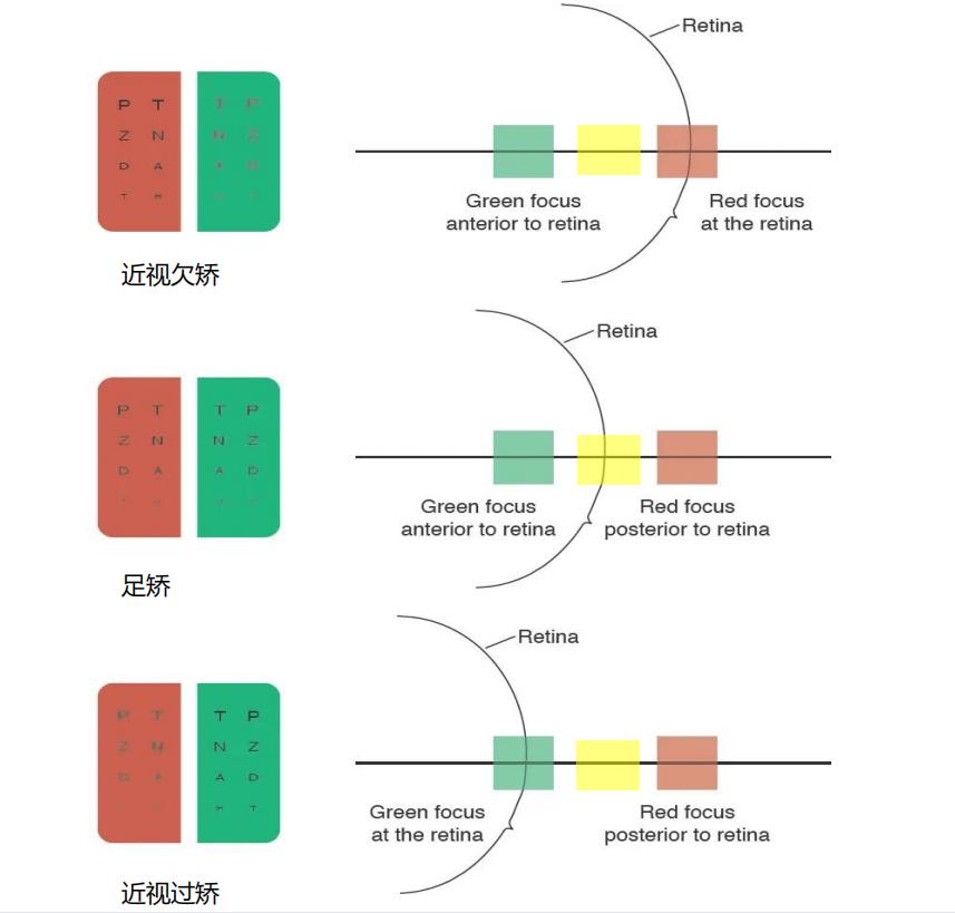 测视力的视力表应该是什么光,视力对照表隐形