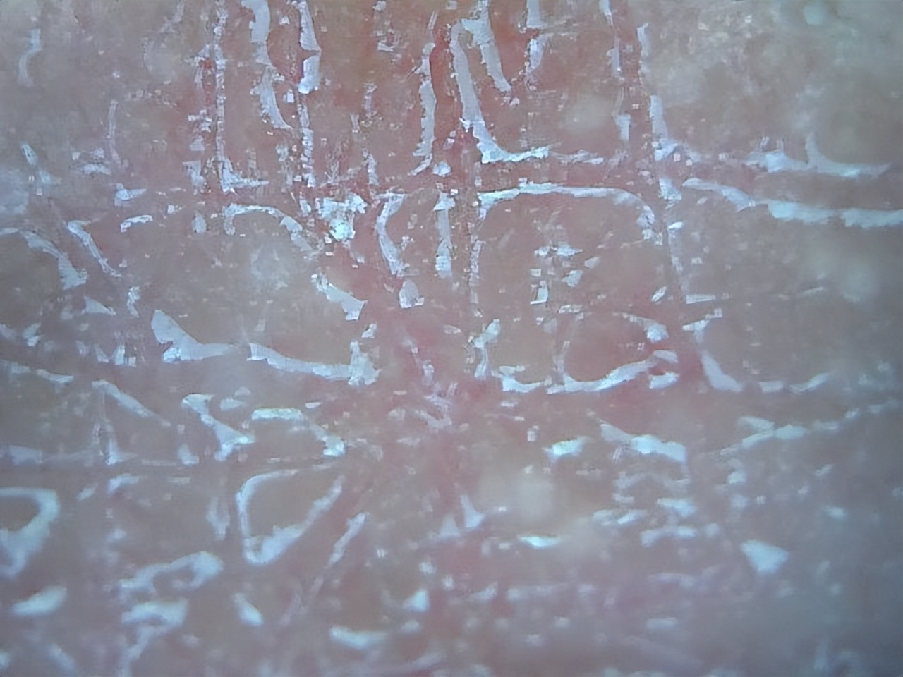 身上老是洗不干净是怎么回事,洗完澡皮肤干痒起白皮屑怎么回事