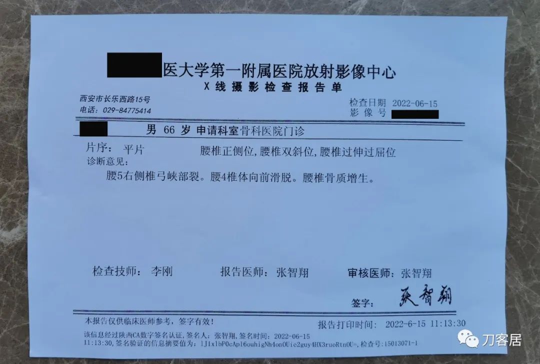 双小腿憋胀麻木,一般腰椎滑脱手术需要卧床多久