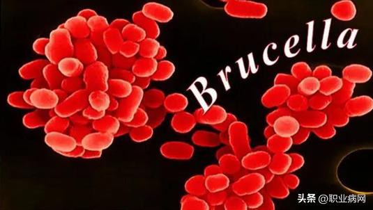 职业卫生科普,布鲁氏菌病属于职业病吗