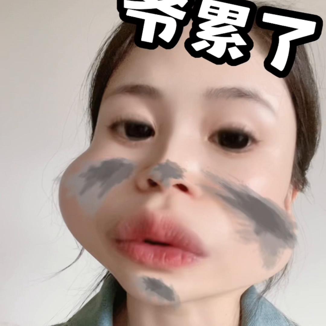 广州医科大学附属第二医院建议听听我说的真的非常生气#医院