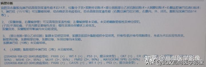 罕见卵巢恶性肿瘤,肿瘤罕见病