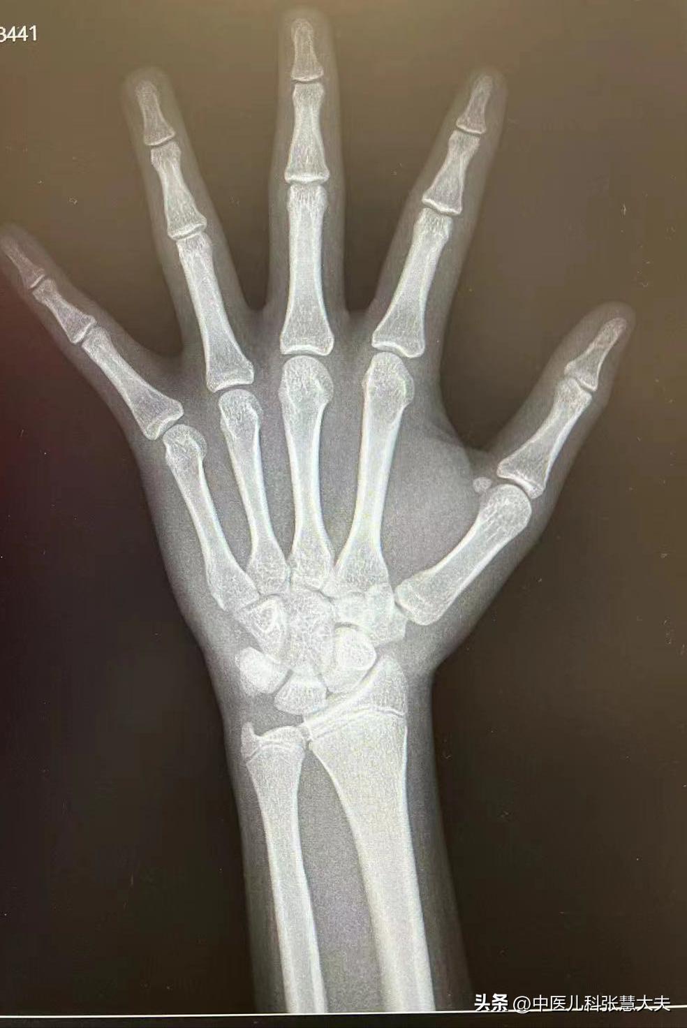 孩子是早成熟好还是晚成熟好,儿童是早长好还是晚长好