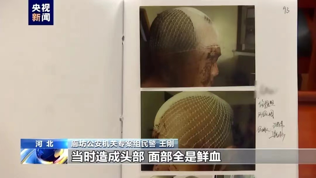 唐山打人事件公布的视频有假？不是受害者本人？这是怎么回事？