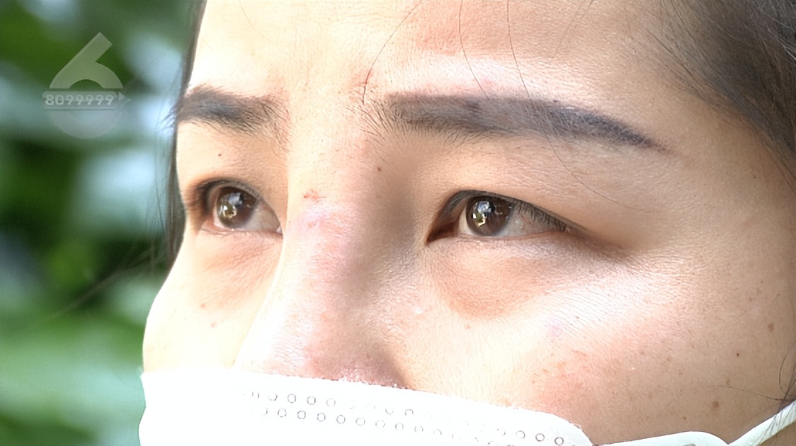 鼻子整形后流脓是不是医疗事故,鼻子整容后流脓怎么处理