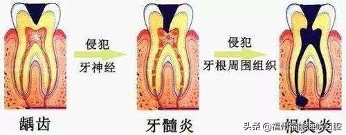 小孩牙齿边缘有黑线要怎么补救,牙齿长黑的东西怎么处理