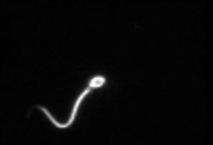 孩子会不会长得像前男友？那些没有成功的精子，最终去了哪里？