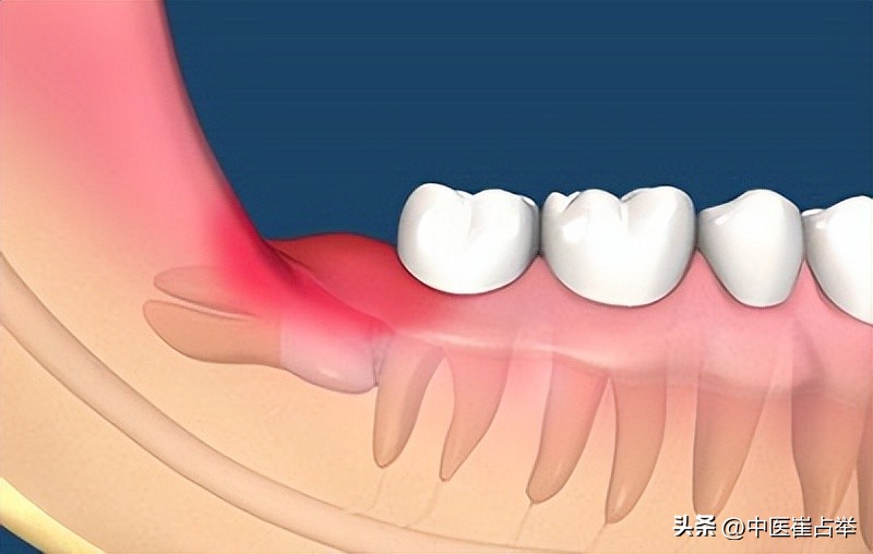 三黄药片100片装一盒多少钱,三黄药片3元