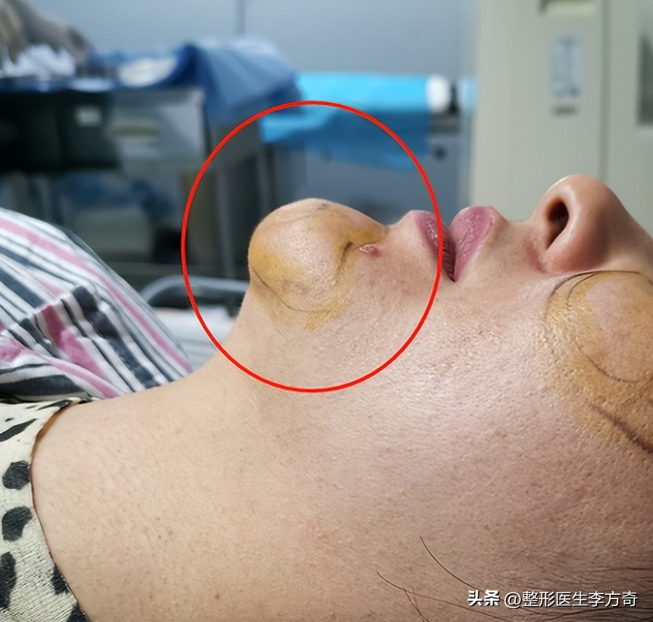 为变美打美容针真的值得吗,脸部变美可以注射几种美容针