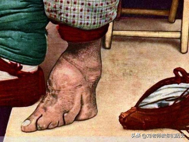 历史上什么朝代开始裹小脚,古代裹小脚的真实目的是什么