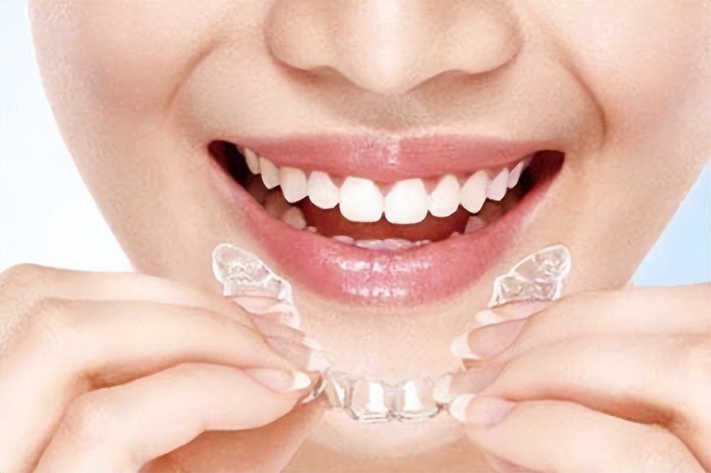 牙齿矫正保持器戴多久,牙齿矫正钢牙要戴多久