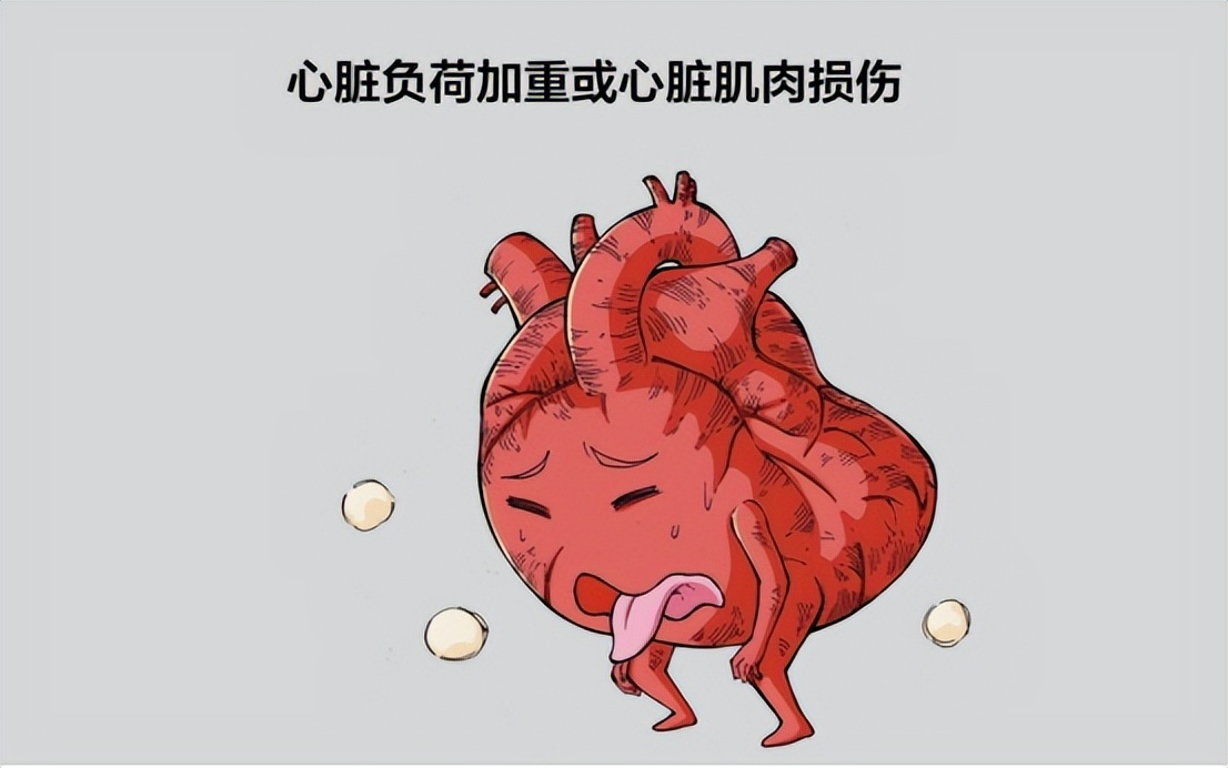 心衰的病因病机,心衰的原因和治疗方法有哪些