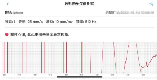 如何选购健康监测智能手表,品牌智能手表与杂牌智能手表区别