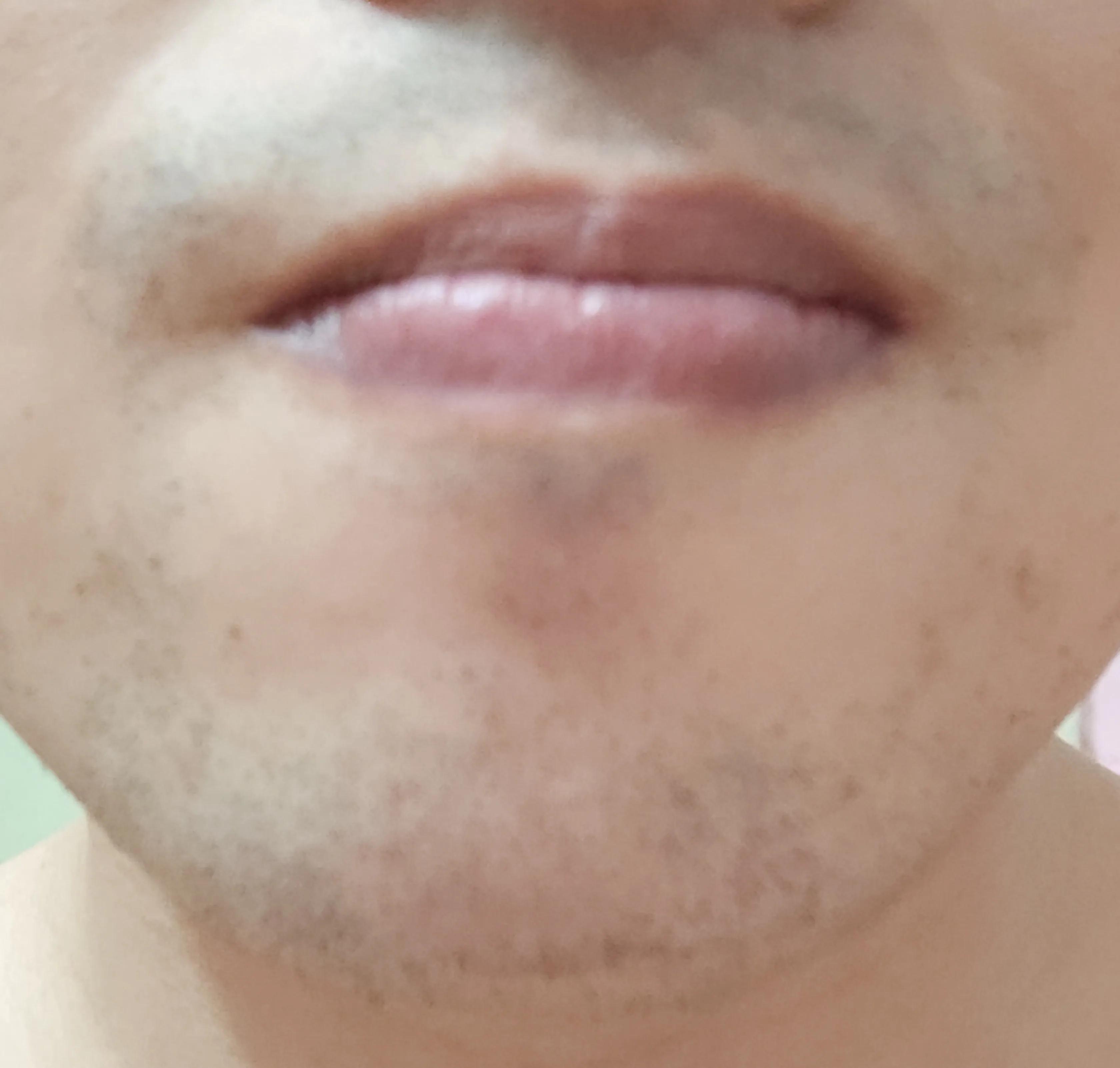 亲测脱毛有效方法,家用脱毛仪亲测