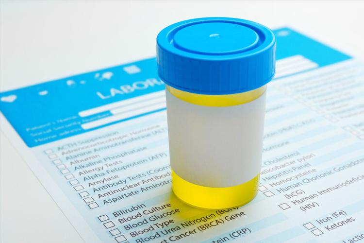 尿蛋白反弹是怎么回事,尿蛋白好了还有反弹怎么回事