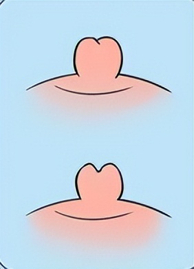 女生胸部上长了白色小点点,女生胸部长了好多小红点疙瘩