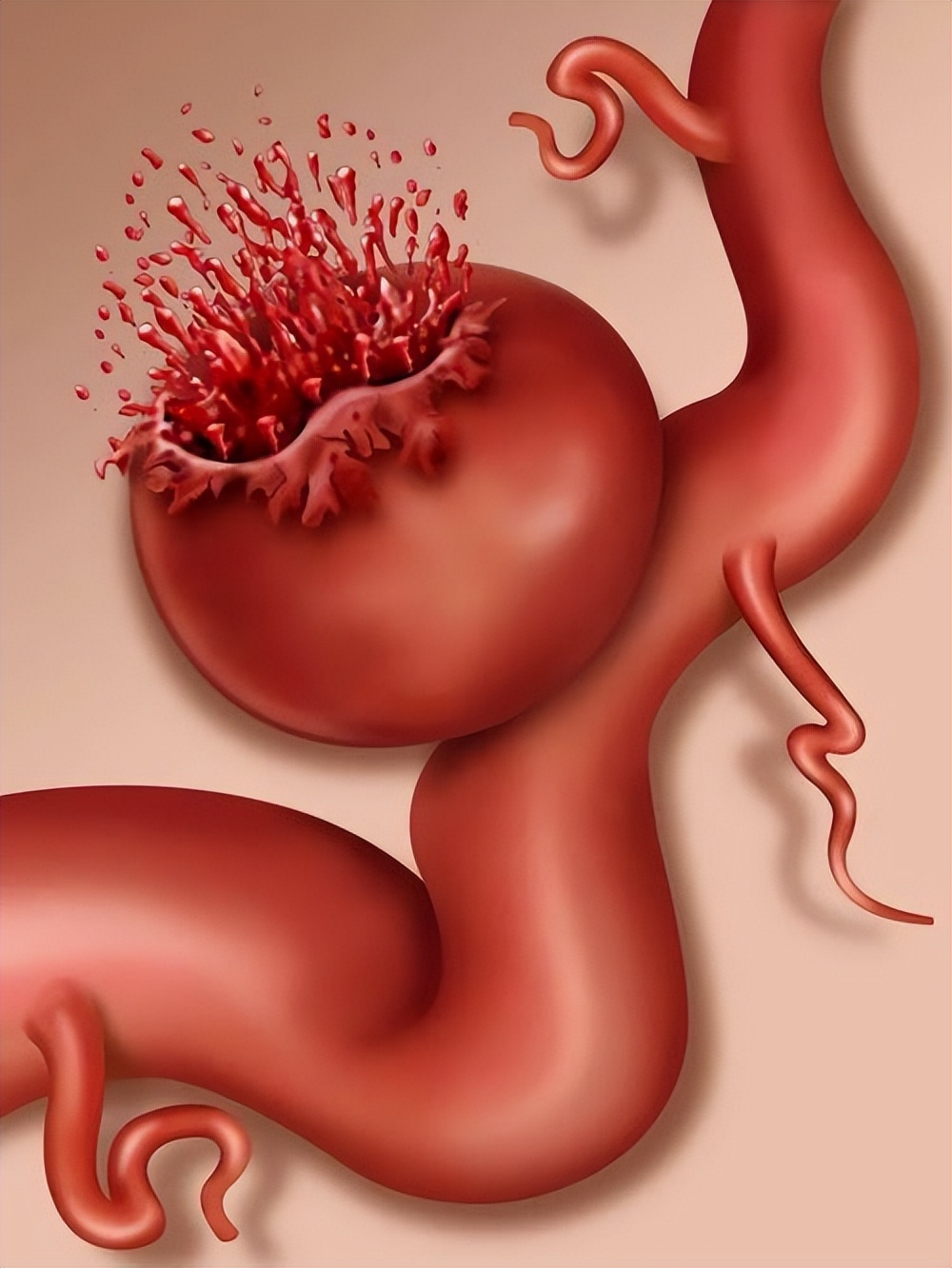 医生在患者清醒下进行开颅,脑子进血开颅手术