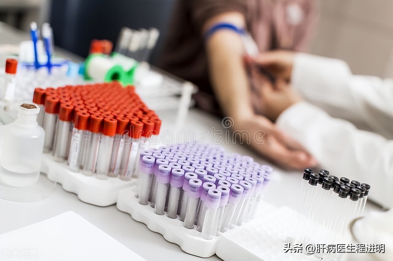肝功十项正常能排除肝病吗,肝功正常能排除哪些大病