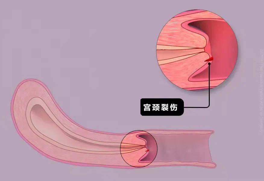 白带变多,生完小孩为什么白带是绿色的