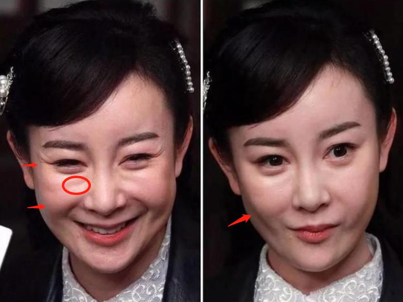 完美女神根本不存在！死皮、黑头、痘痘、毛孔…怼脸暴露真实颜值