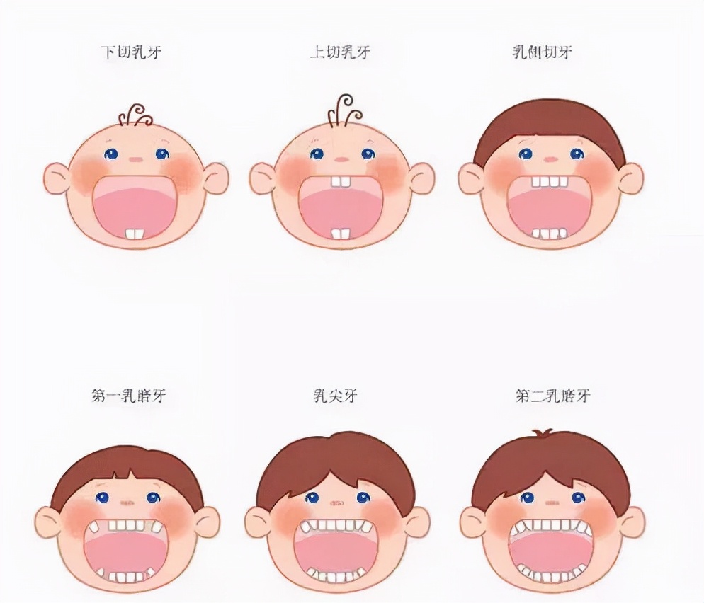 六岁孩子牙齿发黑烂掉怎么处理,孩子牙齿烂掉的原因和处理方法